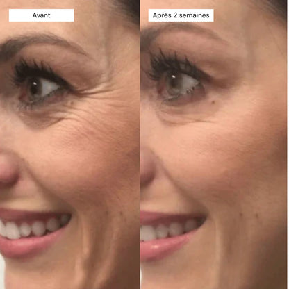 Retinal Shot - Sérum Booster Anti-Âge