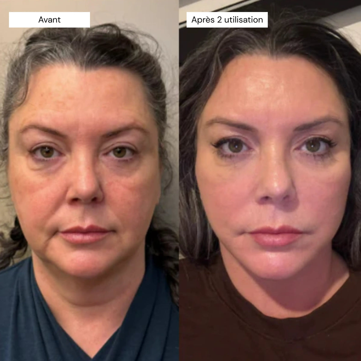 Retinal Shot - Sérum Booster Anti-Âge